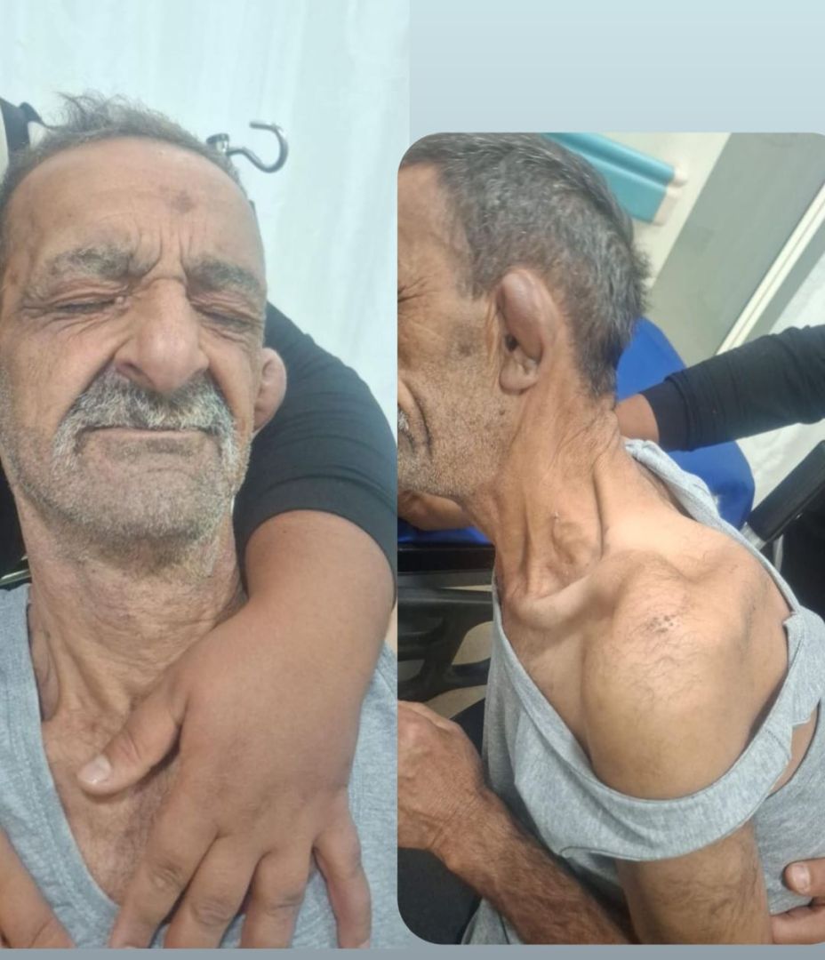 Konya cezaevinde işkence iddiası! 40 gün tutukluluk kırık ve yaralarla bitti