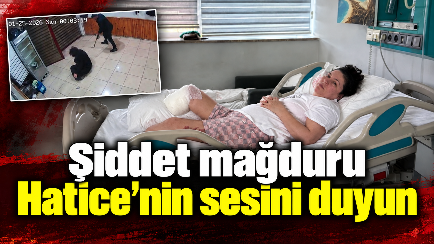 Şiddet mağduru Hatice’nin sesini duyun
